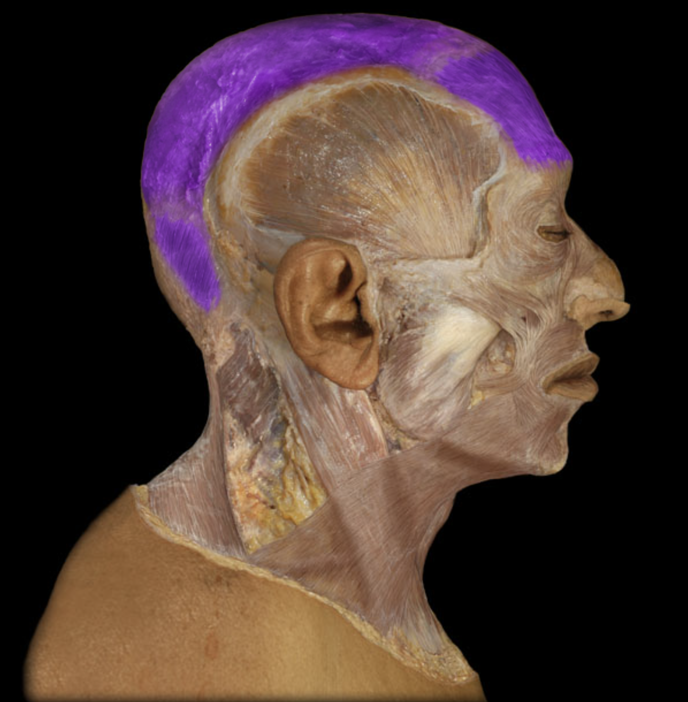 <p>What muscle is this?</p>