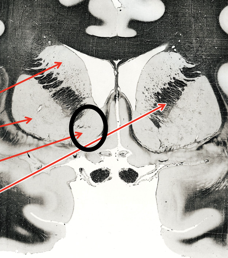 <p>what is the circled region?</p>