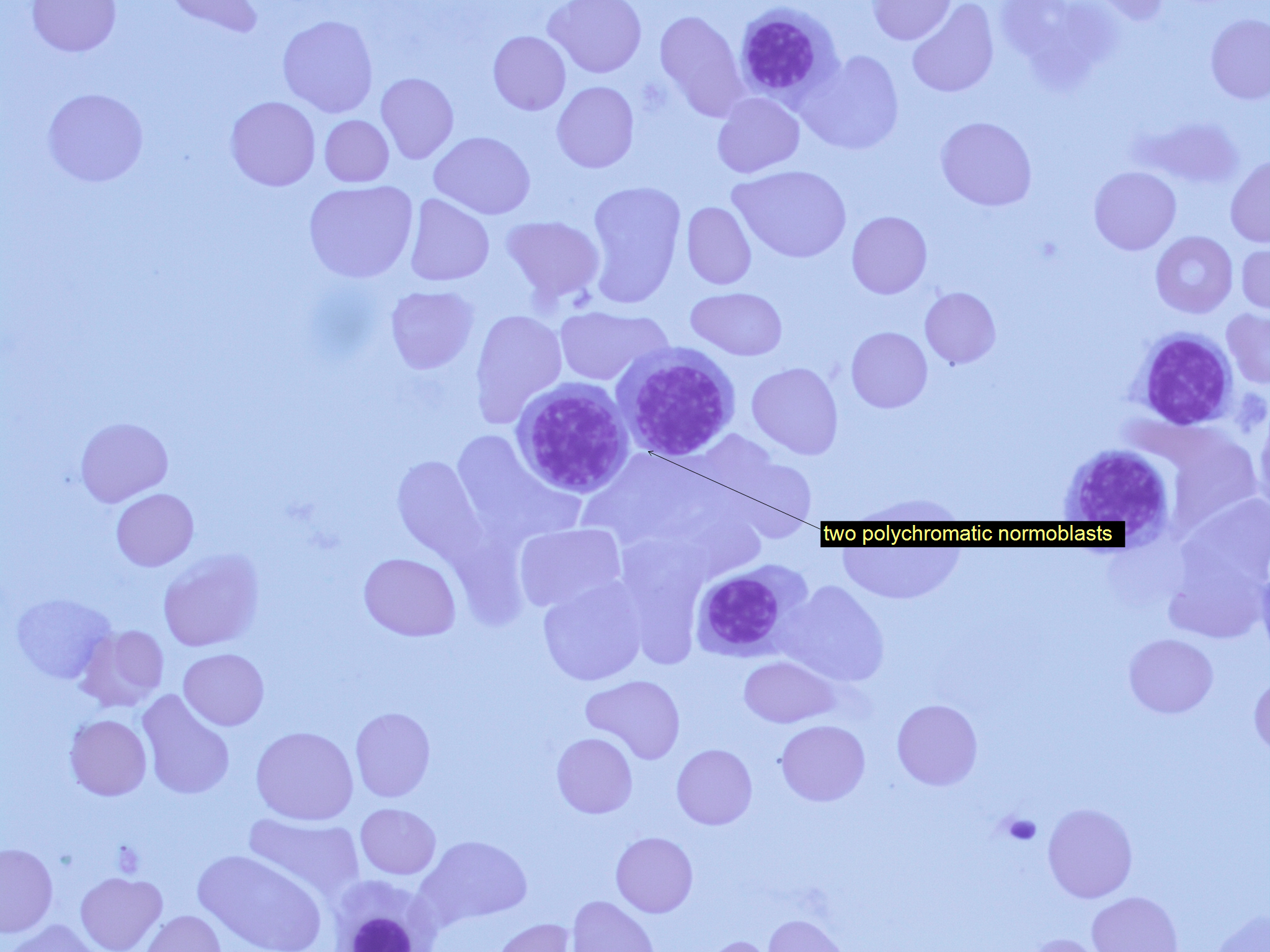 <ul><li><p>12-15</p></li><li><p>lower N:C ratio</p></li><li><p>coarser chromatin</p></li><li><p>blue-gray cytoplasm</p></li><li><p>no granules</p><p></p></li></ul><p></p>