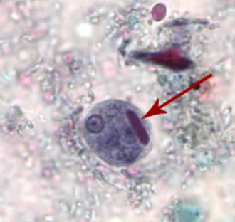 <p>Identify the organism based on the cyst form</p>
