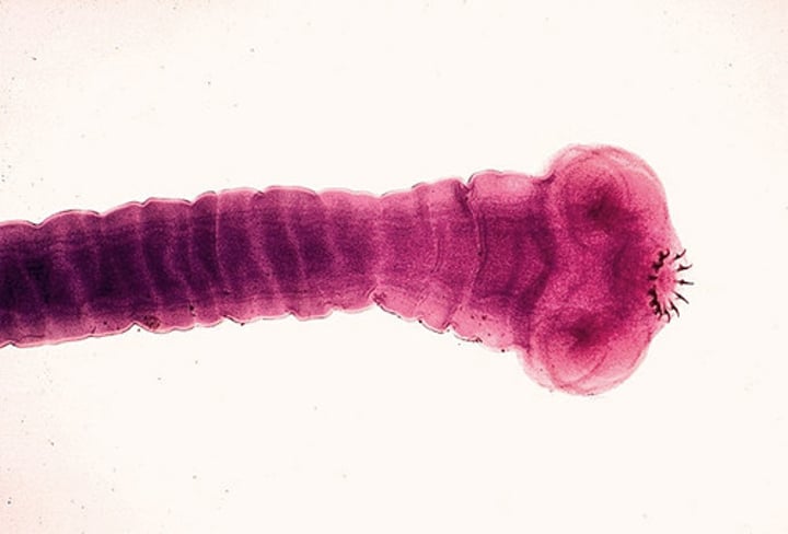 <p>Planarians, trematodes, and tapeworms</p>