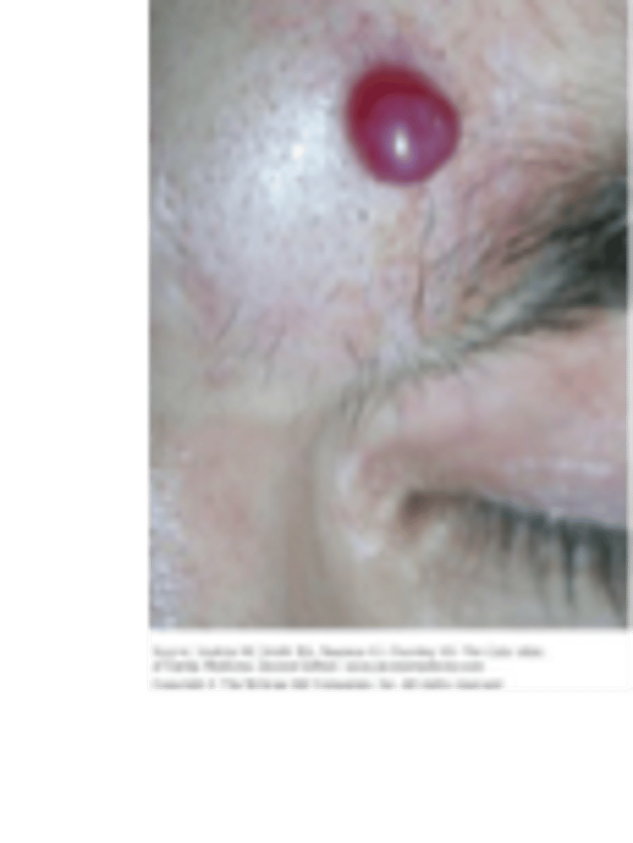 <p>small red papule</p>