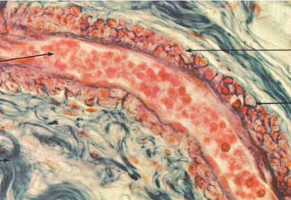 <p>Identify the blood vessel type, the three tunicas and the internal and external elastic membranes.</p>