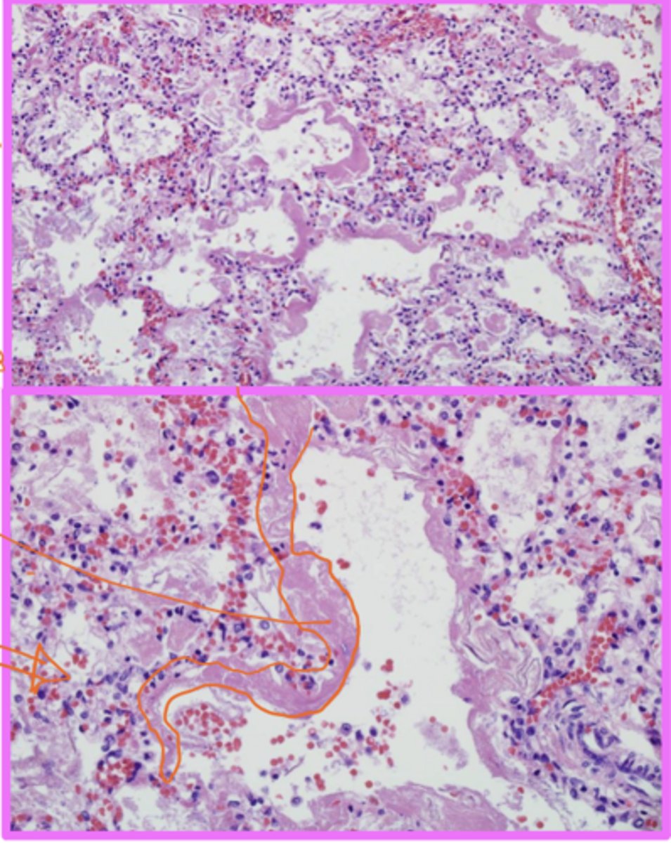 <p>Identify the pathology</p>