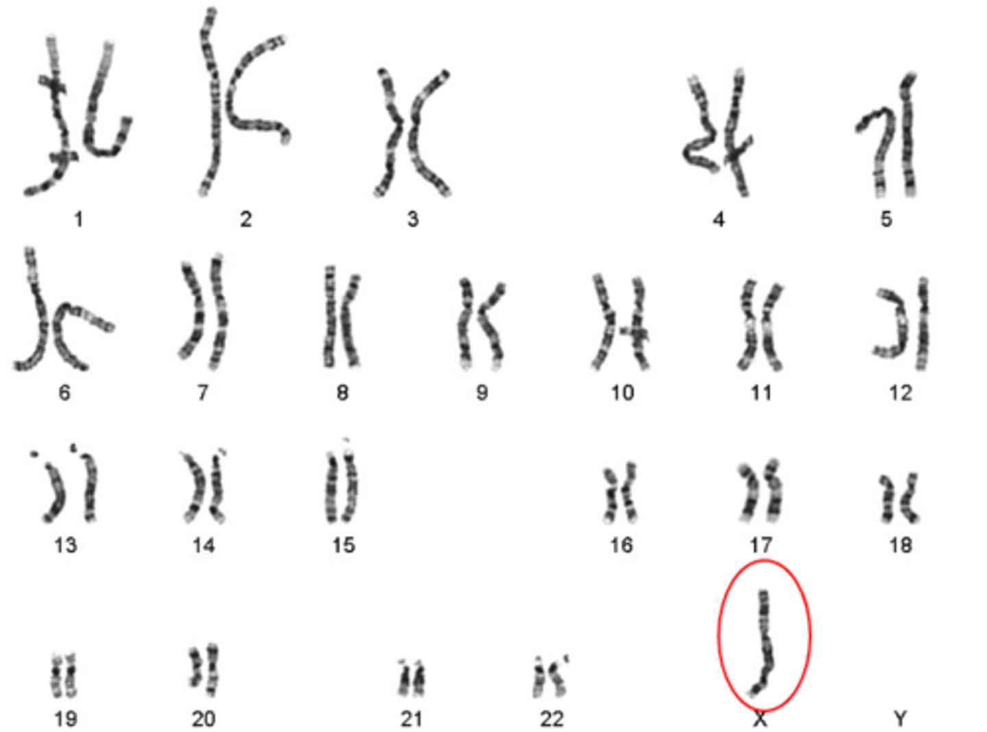 <p>based on the karyotype, identify the genetic disorder:</p>