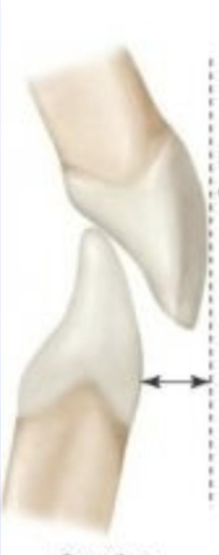 <p>This is an example of </p>