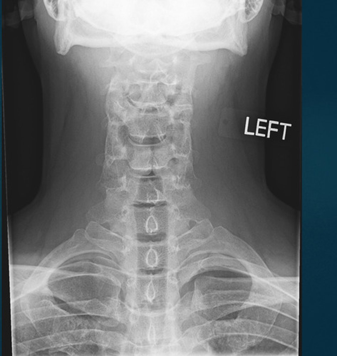 <p>What projection view is this?</p>