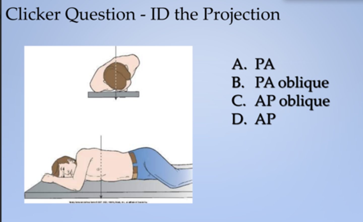 <p>ID the projection:</p><p>RAO radiographic position of chest results in X</p>