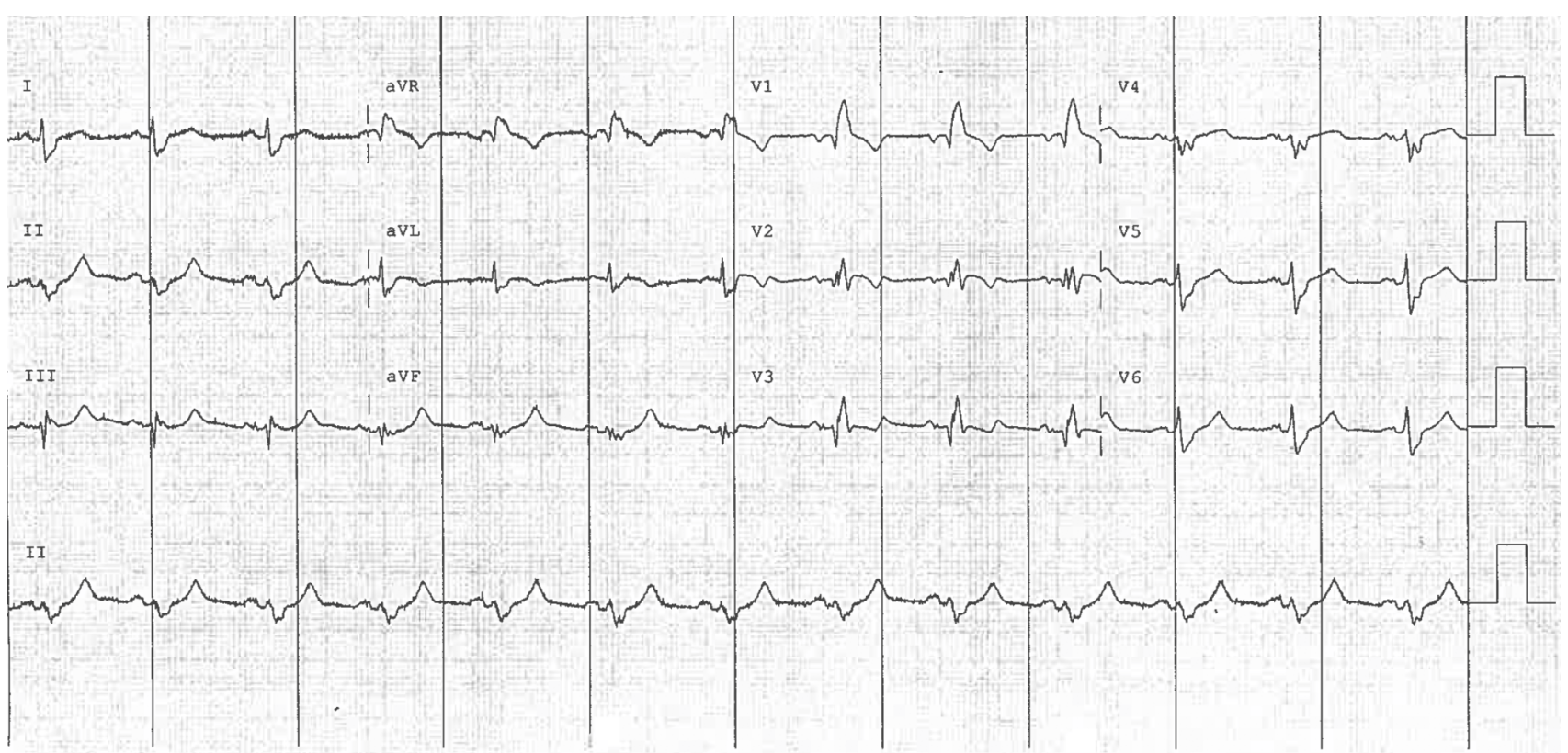 <p>BBB treatment</p>