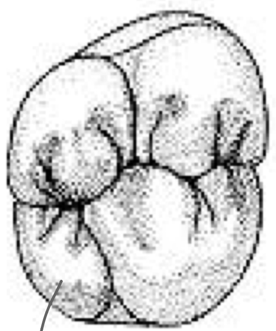 <p>Name the tooth and what you see</p>