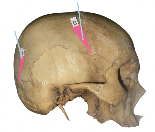 <p>Identify the suture labeled as B.</p>