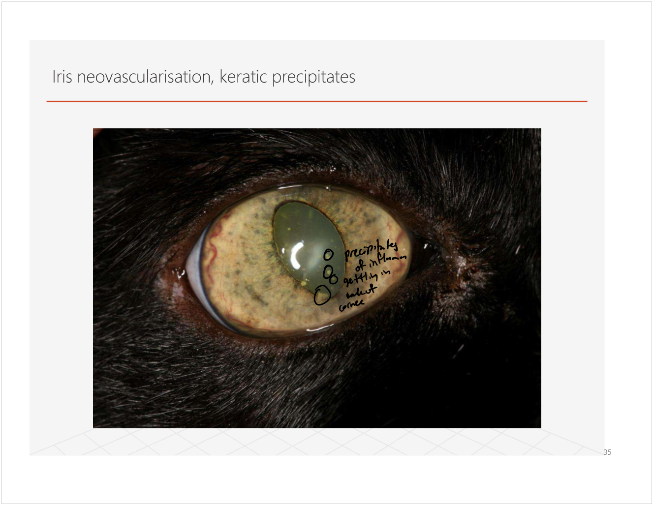 <p><strong>iris neovascularization, keratic precipitates</strong></p><ul><li><p>precipitates of inflamm getting in back of cornea</p></li></ul><p></p>