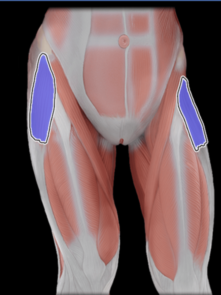 <p>What Muscle Is Highlighted?</p>