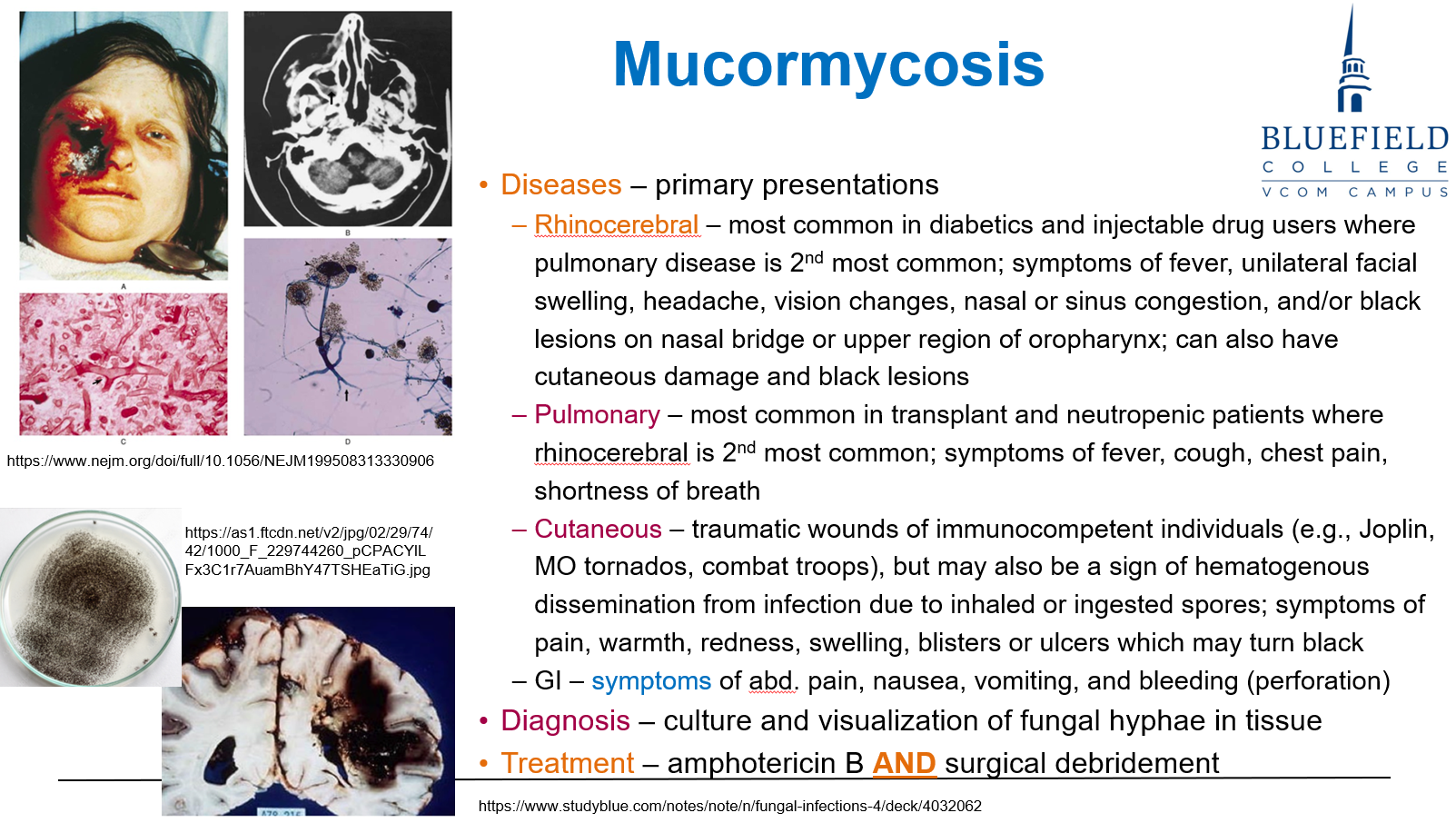 <p>B. Rhinocerebral infection with facial swelling and black eschar<br></p><p><strong>Rhinocerebral mucormycosis</strong> is common in <strong>DKA</strong>, presenting with <strong>facial necrosis</strong> and <strong>vision changes</strong>.</p>