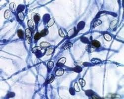 <p>Chytridiomycota (chytrids)</p>