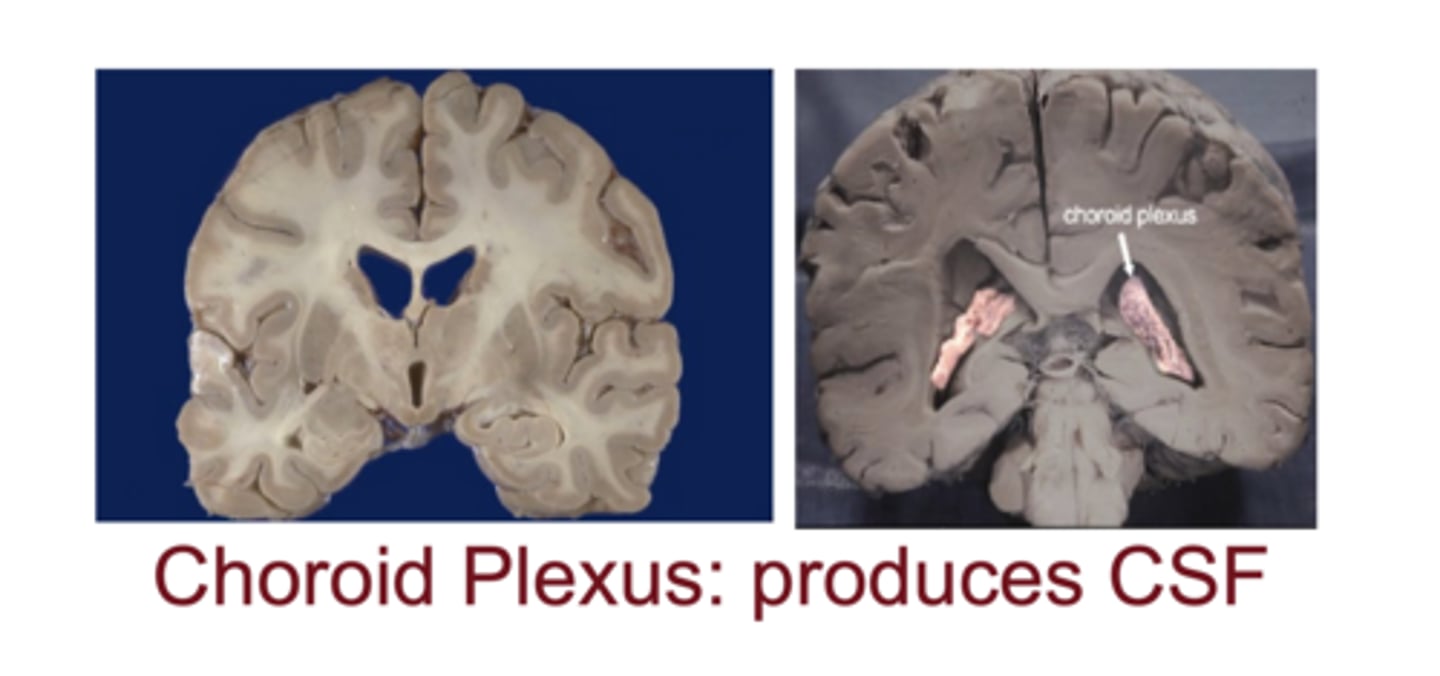 <p>choroid plexus; ~450 mL/day</p><p>**the CSF input</p>