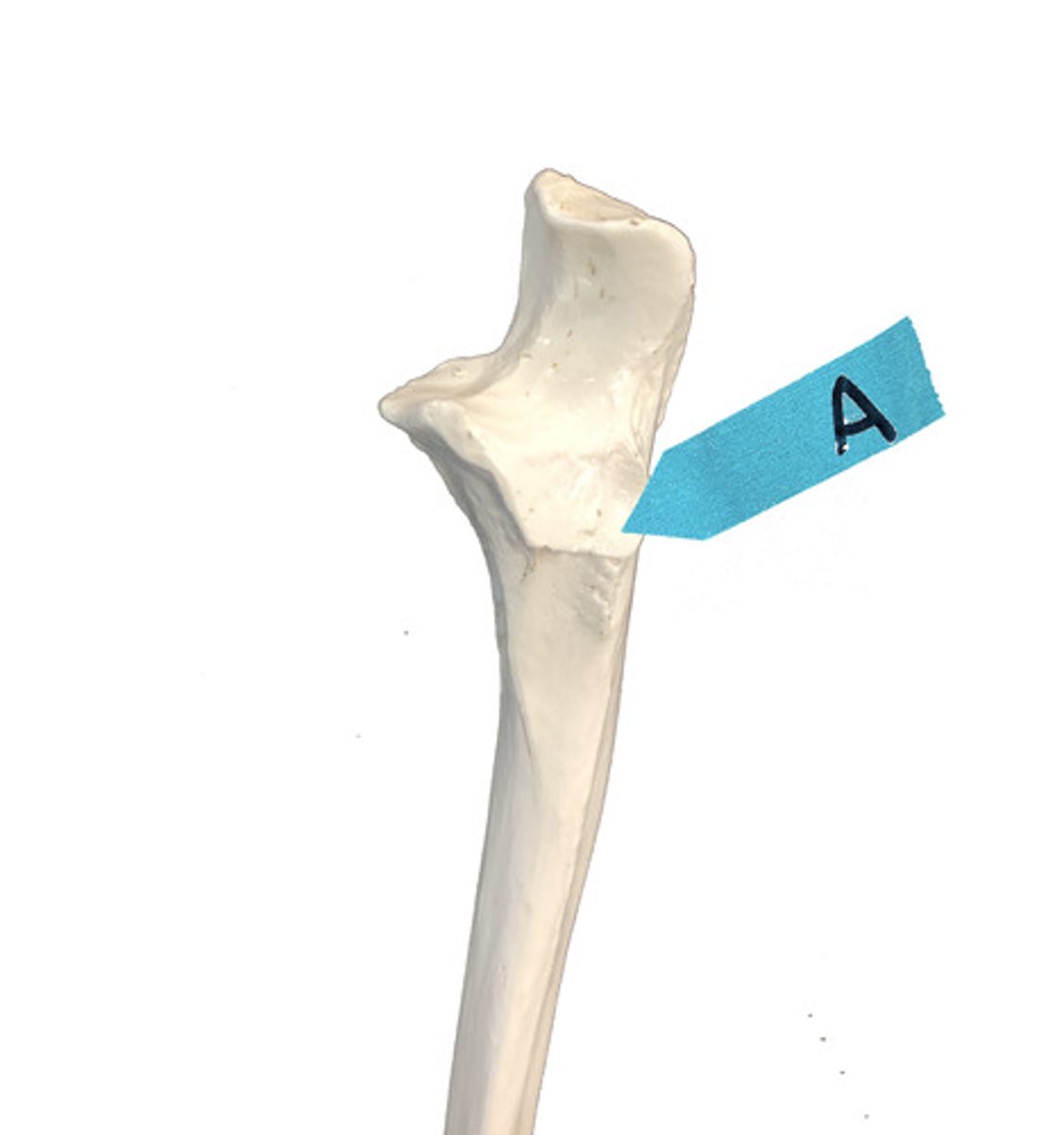 <p>Identify this bone marking.</p>