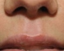 <p>Comment s’appelle le petit sillon vertical situé entre la lèvre supérieure et le nez ?</p>