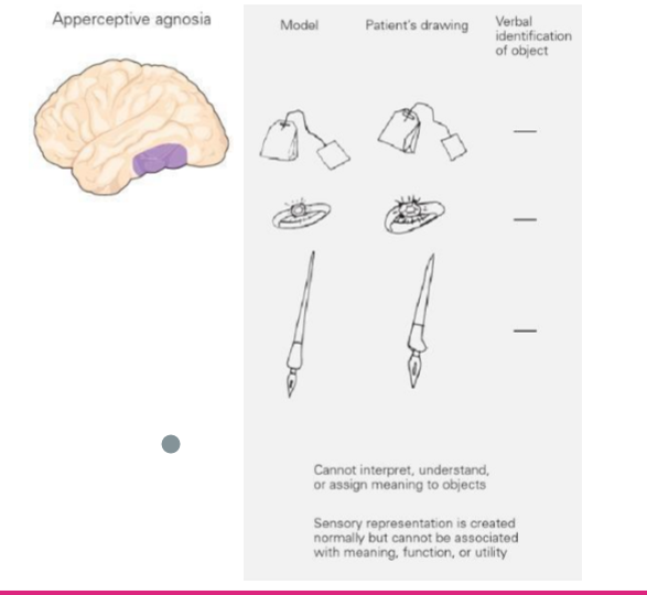 <p>Cannot interpret understand or assign meaning to objects</p><p>sensory representation is created normally but cannot be associative with meaning, function of utility</p>