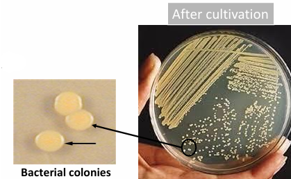 <p><strong>Solid culture media</strong><br>Bacterial growth appears in the form of colonies</p>