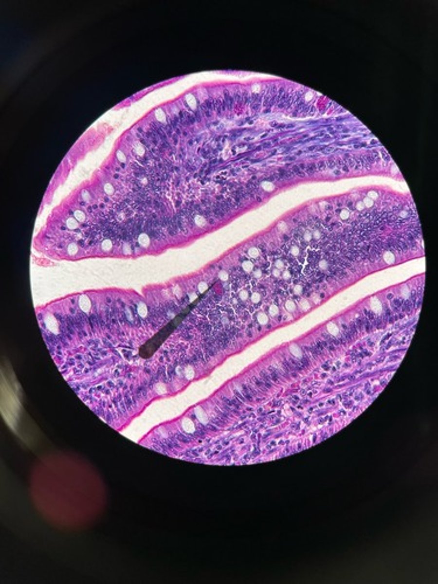 knowt flashcard image