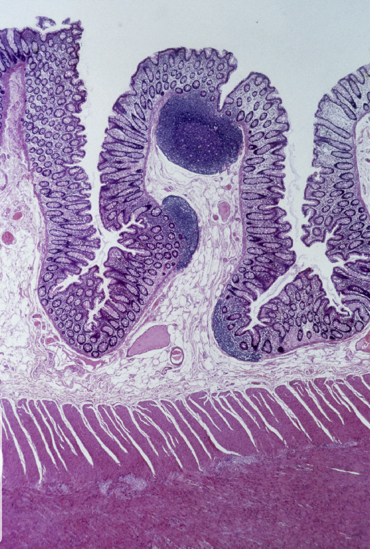 <p>List the layers in the Large intestine</p>