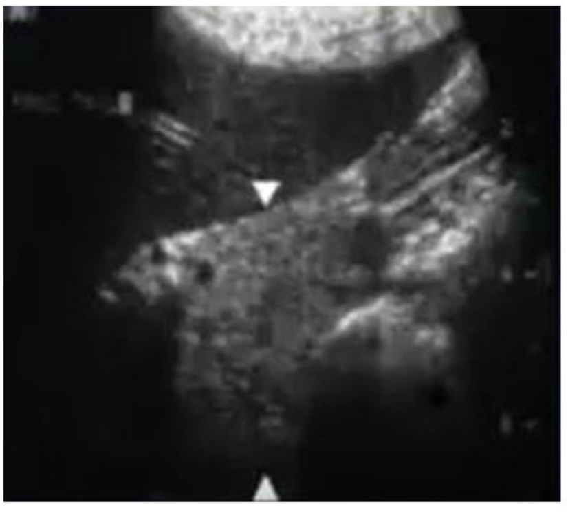 <p>What is this image showing?</p>