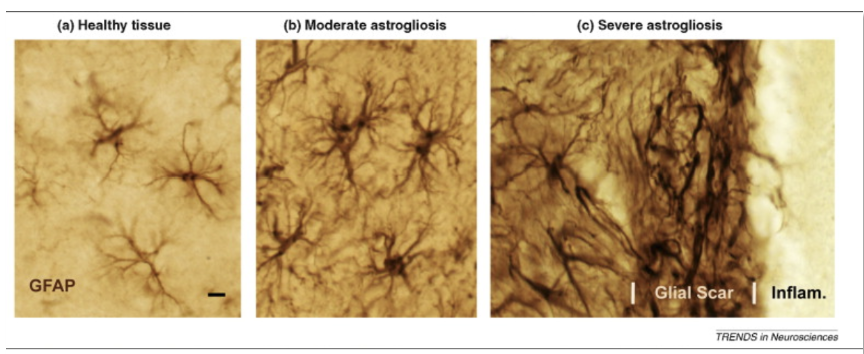 <p>regions of lost neurons but impede the regeneration of axons </p>