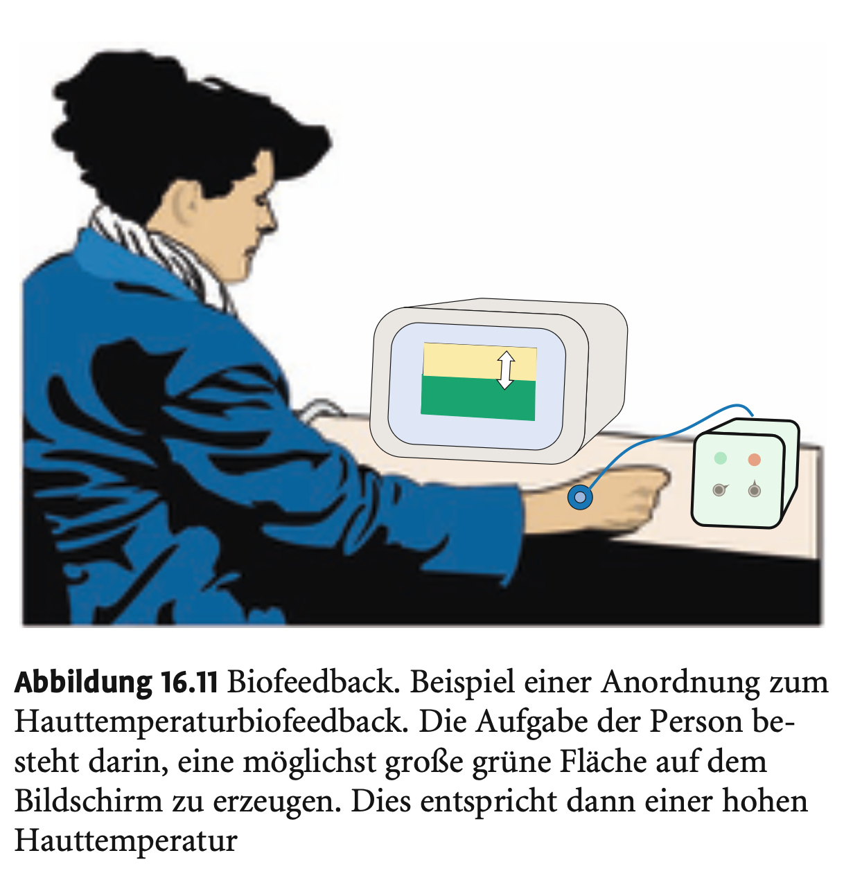 <p><strong>Grundprinzip</strong></p><p>&nbsp;</p><ul><li><p><strong>Biofeedback</strong> bedeutet: <strong>Rückmeldung biologischer Prozesse</strong> an den Patienten, sodass dieser lernt, <strong>willentlich Einfluss</strong> auf diese zu nehmen.</p></li><li><p>Ziel: <strong>Selbstkontrolle über physiologische Vorgänge</strong> (z. B. Muskeltonus, Herzfrequenz, Gefäßtonus, EEG-Aktivität).</p></li><li><p>Besteht aus 3 Hauptkomponenten:</p><ol type="1"><li><p><strong>Organismus</strong> als Signalquelle (z. B. Hauttemperatur)</p></li><li><p><strong>Messsystem</strong>, das die biologische Aktivität aufzeichnet</p></li><li><p><strong>Signalgeber</strong> (visuell, akustisch), der dem Patienten Veränderungen rückmeldet</p></li></ol></li></ul><p></p><p></p><p><strong>Indikationen</strong></p><p>&nbsp;</p><ul><li><p><strong>Chronische Schmerzen</strong> (z. B. Rücken, Migräne, Spannungskopfschmerz)</p></li><li><p><strong>Vegetative Beschwerden</strong> (Herzrate, Blutdruck)</p></li><li><p><strong>Muskuläre Störungen</strong> (z. B. bei Kiefergelenksschmerzen)</p></li><li><p><strong>Psychosomatische Beschwerden</strong> (z. B. bei Angststörungen)</p></li></ul><p>&nbsp;</p><p>&nbsp;</p><p>&nbsp;</p><p><strong>Wirkmechanismen</strong></p><p>&nbsp;</p><ul><li><p><strong>Direkte Wirkung</strong>: Regulation des Zielparameters (z. B. Muskeltonus).</p></li><li><p><strong>Indirekte Wirkung</strong>:</p><ul><li><p>Verbesserung der <strong>Körperwahrnehmung</strong></p></li><li><p>Förderung der <strong>Selbstwirksamkeit</strong>: Patient erlebt, dass er seinen Körper beeinflussen kann.</p></li><li><p>Erhöht <strong>Konkordanz zwischen Empfinden und biologischer Aktivität</strong></p></li><li><p>Trägt zur <strong>Differenzierung von körperlichen und psychischen Schmerzursachen</strong> bei</p></li></ul></li></ul><p>&nbsp;</p><p>&nbsp;</p><p>&nbsp;</p><p><strong>Kombinationstherapie</strong></p><p>&nbsp;</p><ul><li><p>Biofeedback wird <strong>meist mit verhaltenstherapeutischen Maßnahmen</strong> kombiniert.</p></li><li><p>Besonders sinnvoll bei Patienten, denen <strong>Zusammenhänge zwischen Psyche und Körper</strong> nicht bewusst sind.</p></li></ul><p></p><p></p><p><strong>Biofeedback bei spezifischen Schmerzsyndromen</strong></p><ol><li><p>Chronische Rückenschmerzen</p></li><li><p>Spannungskopfschmerz</p></li><li><p>Migräne</p></li></ol><p></p>