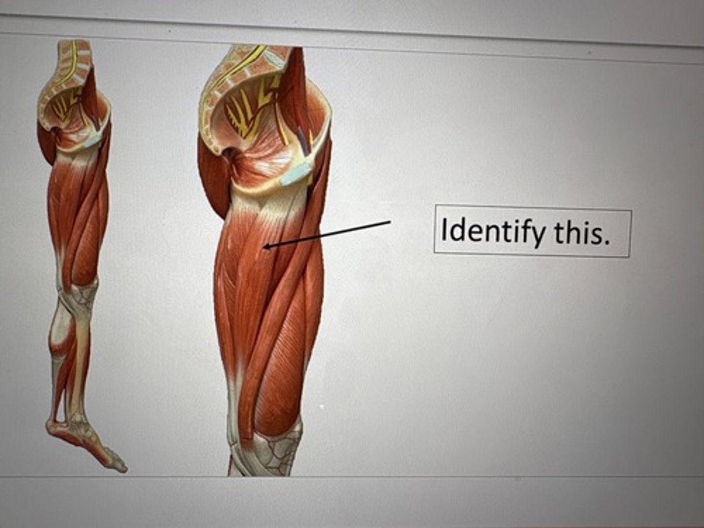 term image
