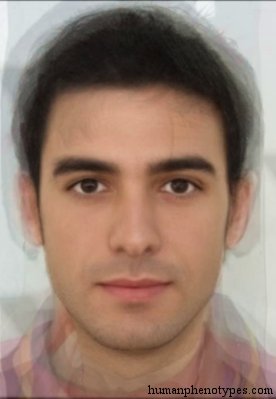 <p>Identify this Phenotype</p>