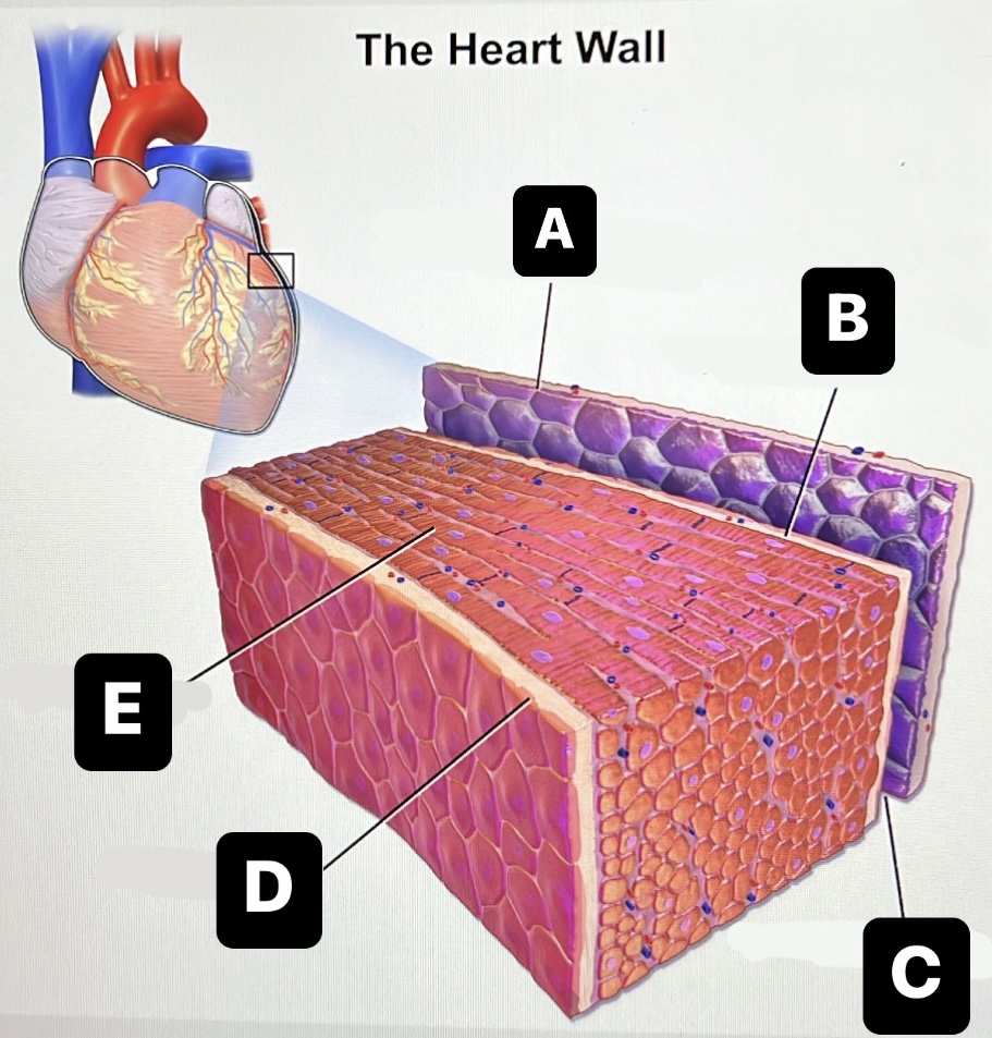 <p>endocardium</p>