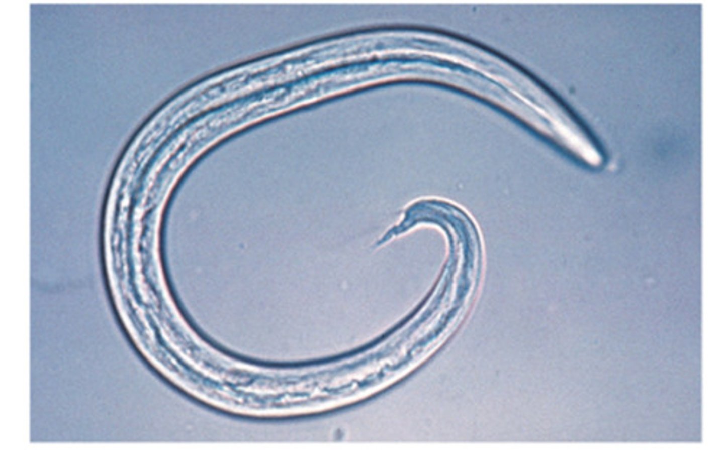 <p>Nematode lungworm, found in goats and sheep</p>