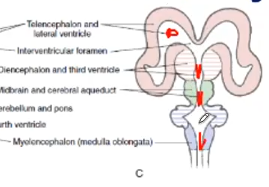 <p>Lateral ventricles</p>