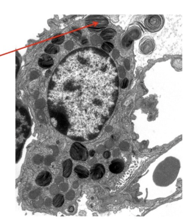 <p>In the attached EM of an alveolus, the structure indicated by the arrow is most likely which of the following?</p>