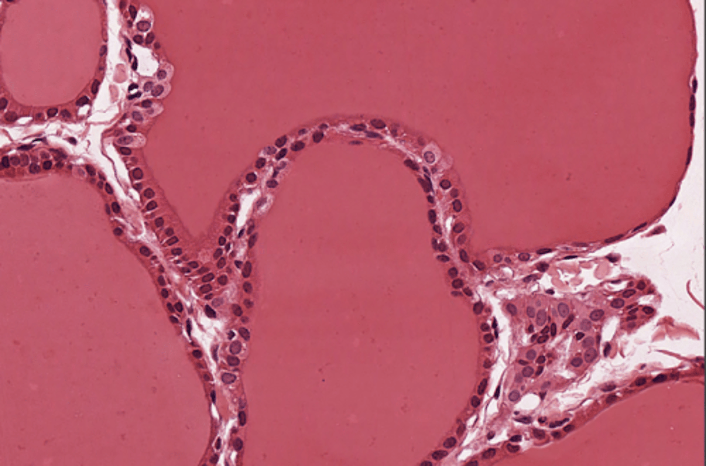 <p>produces hormones that regulate metabolism, body heat, and bone growth</p>