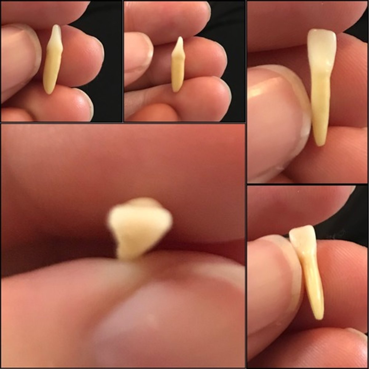 <p>What tooth is this ?</p>