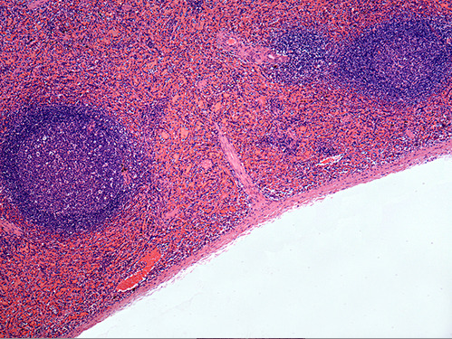 <p><span>This is an image of which lymphatic organ? <strong>spleen</strong></span></p>