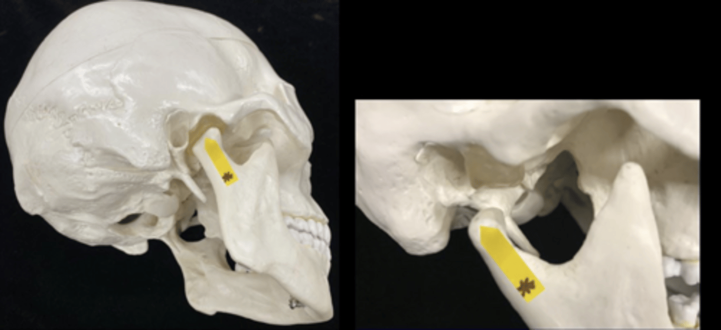 <p>name the bone and bone feature </p>