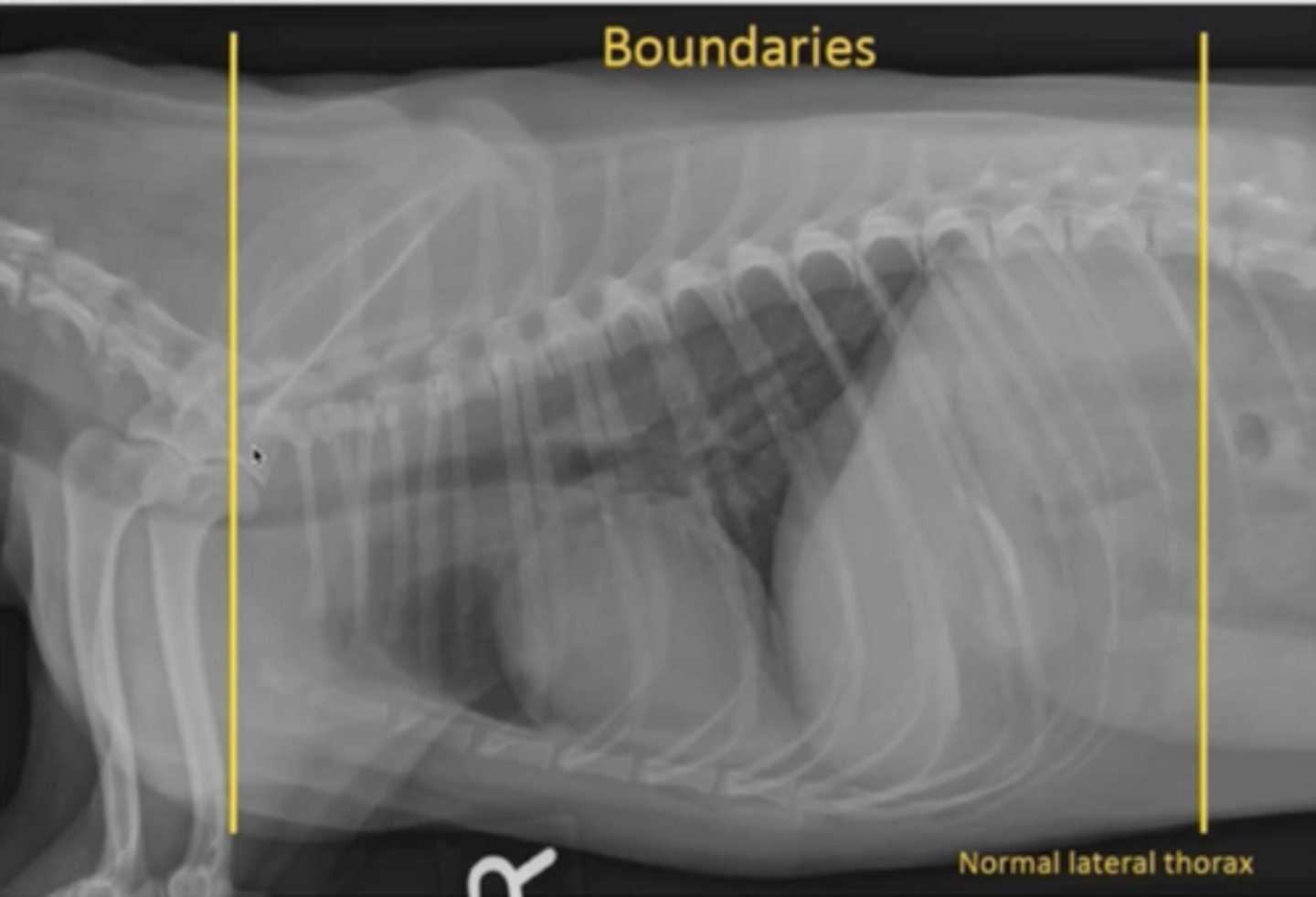 <p>Caudal boundary for thoracic imaging</p>