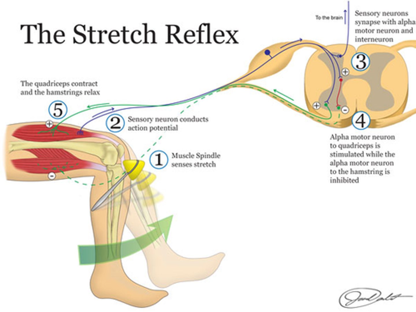 <p>-Stretch Reflex</p><p>-Flexor (Withdrawal) Reflex</p><p>-Crossed Extensor Reflex</p>
