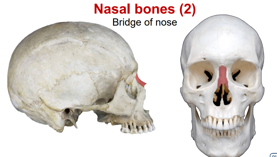 <p>Bridge of nose</p>