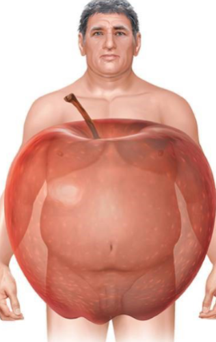 <ul><li><p>cluster of five risk factors</p></li><li><p>High blood pressure comes from storing fat into adipose tissues, which are vascularized. This means more work for heart to pump blood to those sites</p></li></ul><p></p>