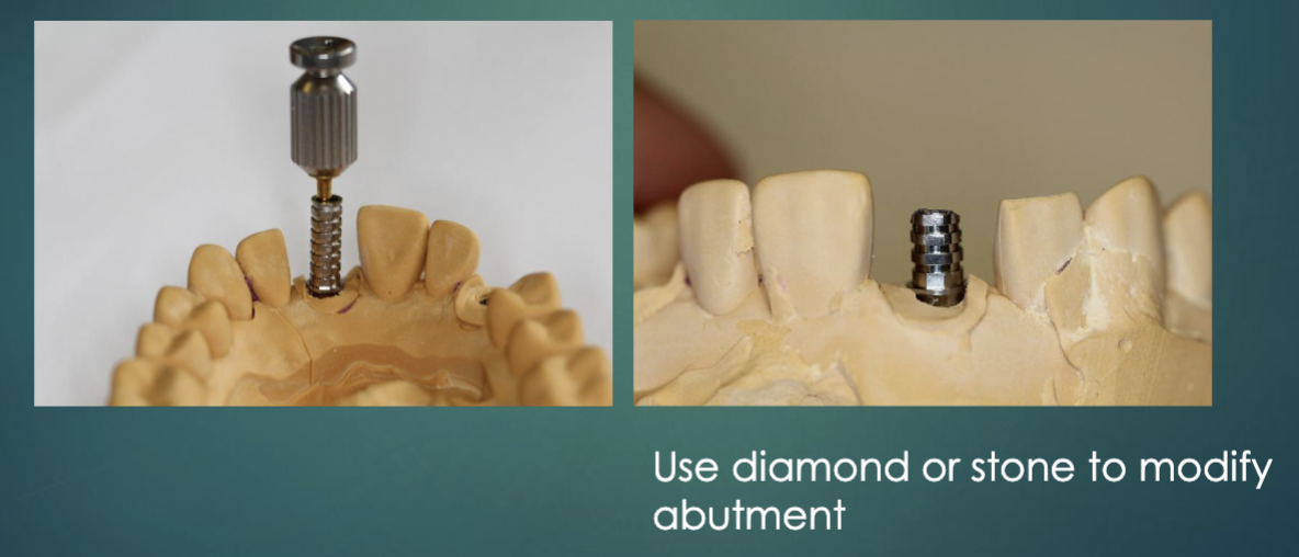 <p>secure abutment to cast and modify </p>