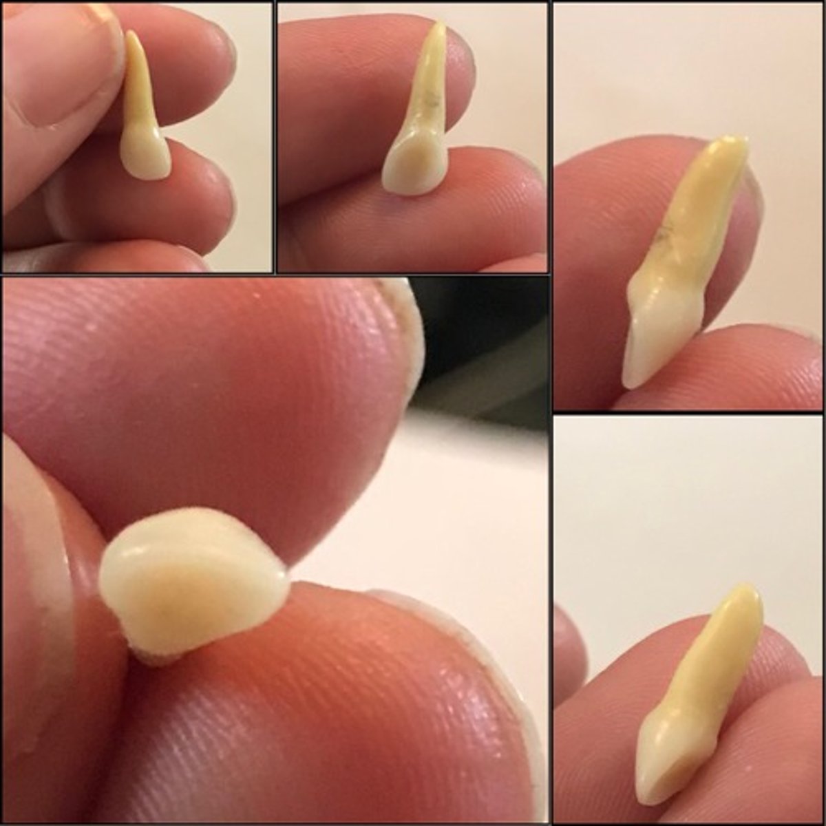 <p>What tooth is this ?</p>