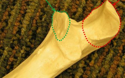 <p>What is the red area? </p>