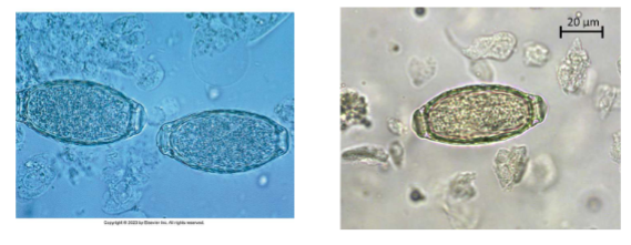 <p>bladder worm of dogs, foxes, and cats</p>