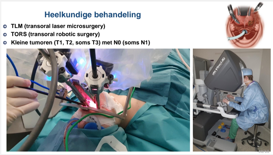 <p>TLM (transoral laser microsurgery)<br>TORS (transoral robotic surgery)<br>Kleine tumoren (T1, T2, soms T3) met N0 (soms N1)</p>