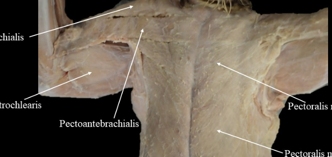 <p>long stretch of muscle, could be above or below pectoralis major</p>