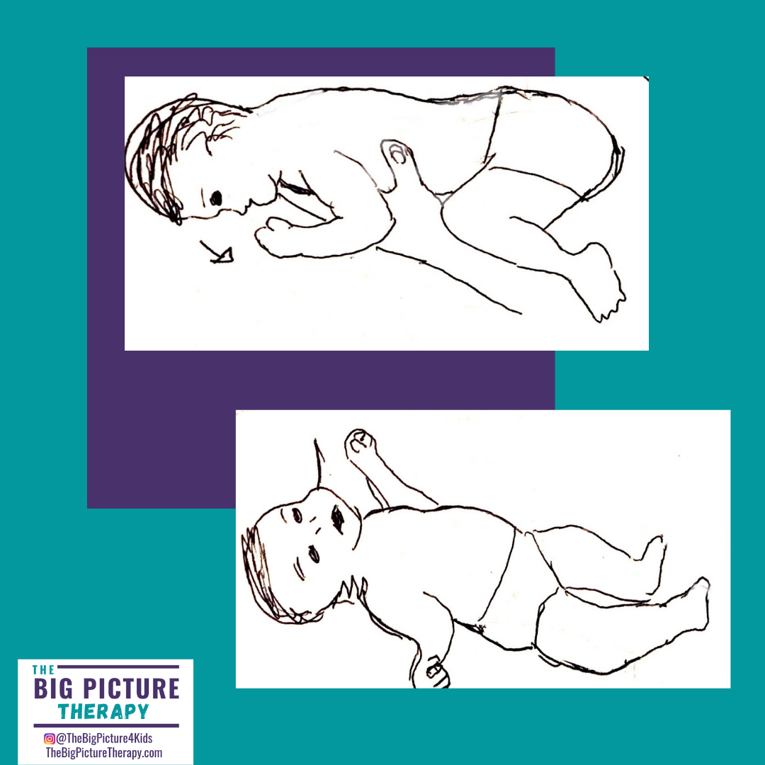 <p><strong>Stimulus:</strong> (1) supine; (2) prone</p><p><strong>Response:</strong> (1) predominant extensor tone; (2) predominant flexor tone</p><p><strong>Age of Suppression:</strong> 4-6 months</p>